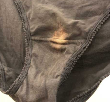 If You Find A “Bleach” Patch On Your Underwear, You’d Better Know What It Means