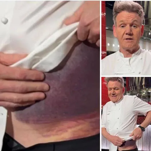 Gordon Ramsay shares important message after potentially fatal accident
