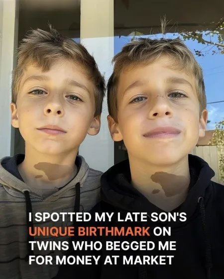 ‘We Want to Eat,’ Twins Beg Lady, She Notices They Have Her Late Son’s Birthmark