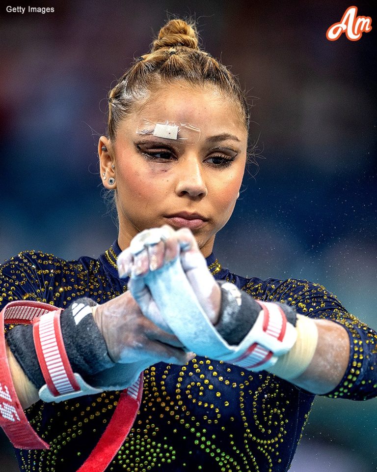 Why Did Flavia Saraiva Compete at the Olympics with a Bandaged Face – Top 3 Gymnast Injuries This Year