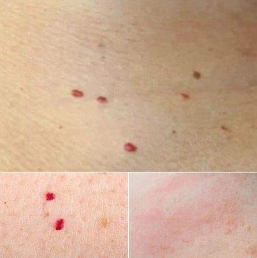 Red Dots on Your Skin: Causes and What They Could Mean