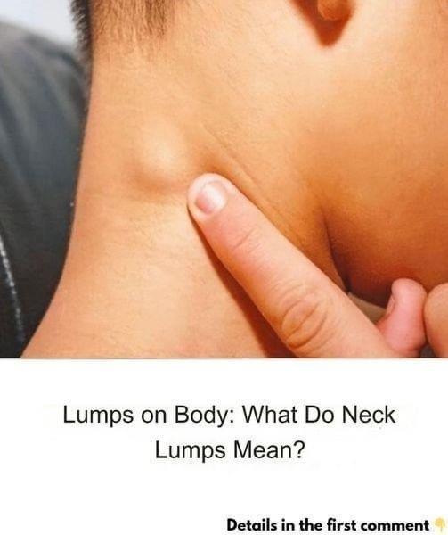 When to worry about neck lumps and what to do about them