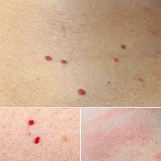 Red Dots on Your Skin…