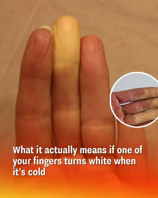 Your Fingertips May Change Color