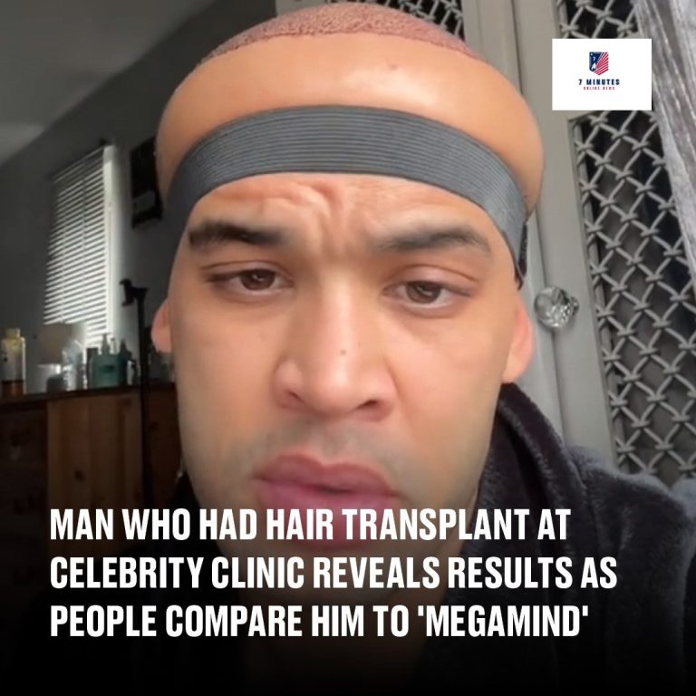 Man who had hair transplant at celebrity clinic reveals results as people compare him to ‘Megamind’