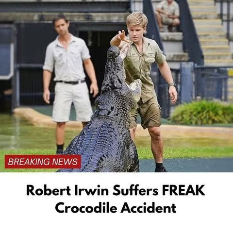 Robert Irwin Suffers FREAK Crocodile Accident Just HOURS Before Awards Show