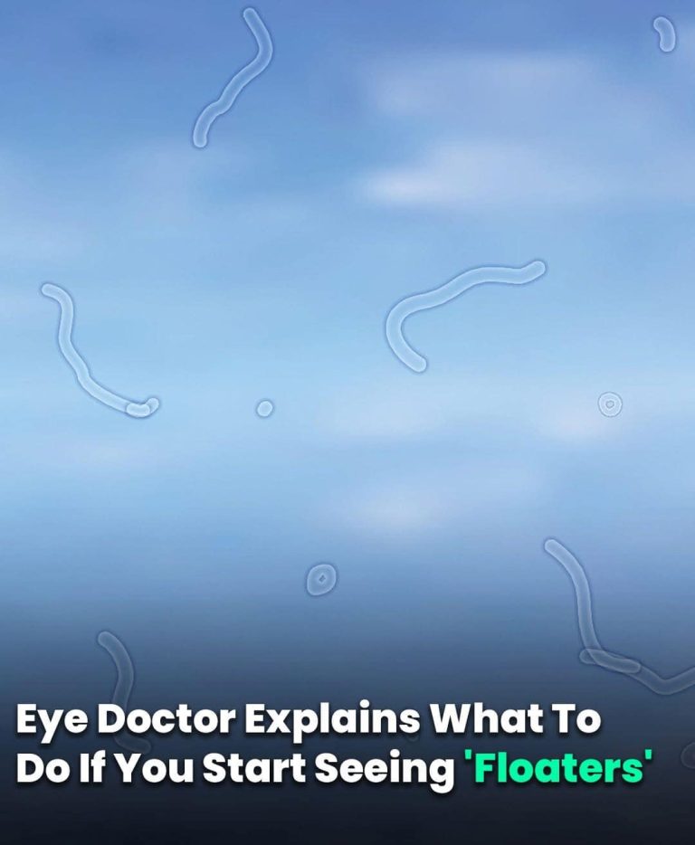 Eye Doctor Explains What To Do If You Start Seeing