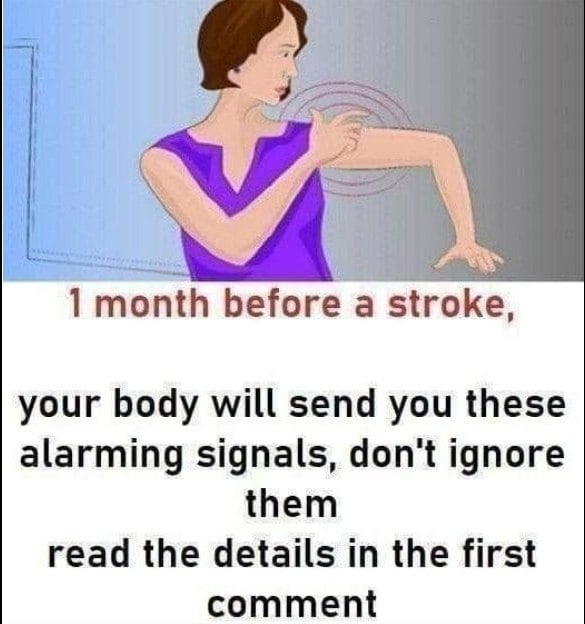 Stroke: These indicators that manifest one month prior to..