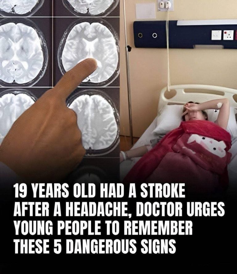 15 warning signs of stroke in young adults