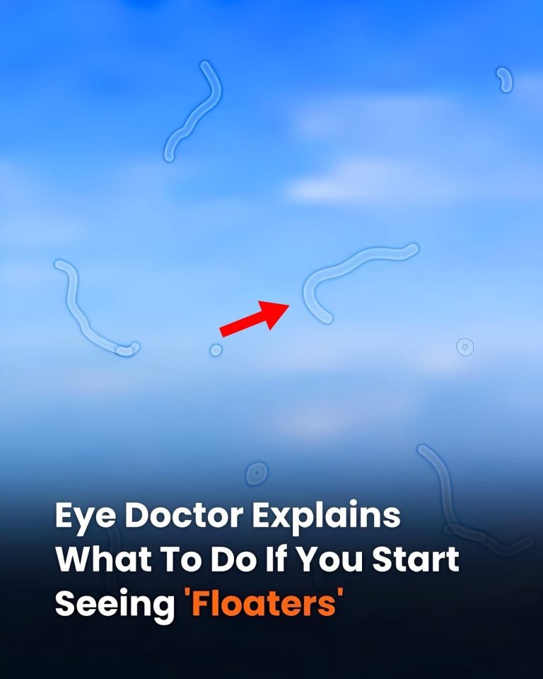 Eye Doctor Explains What To Do If You Start Seeing
